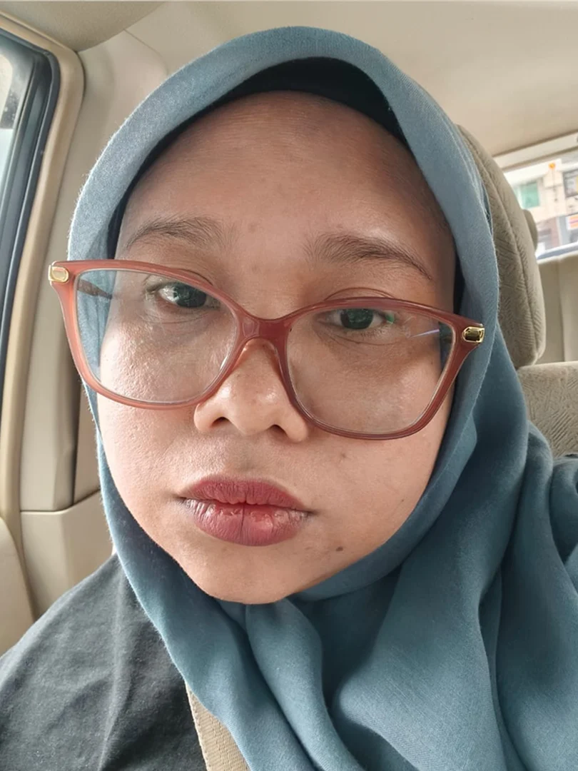 farhana-selepas