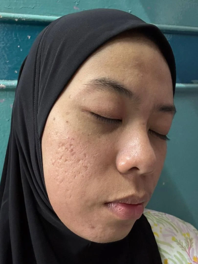 nurul-after
