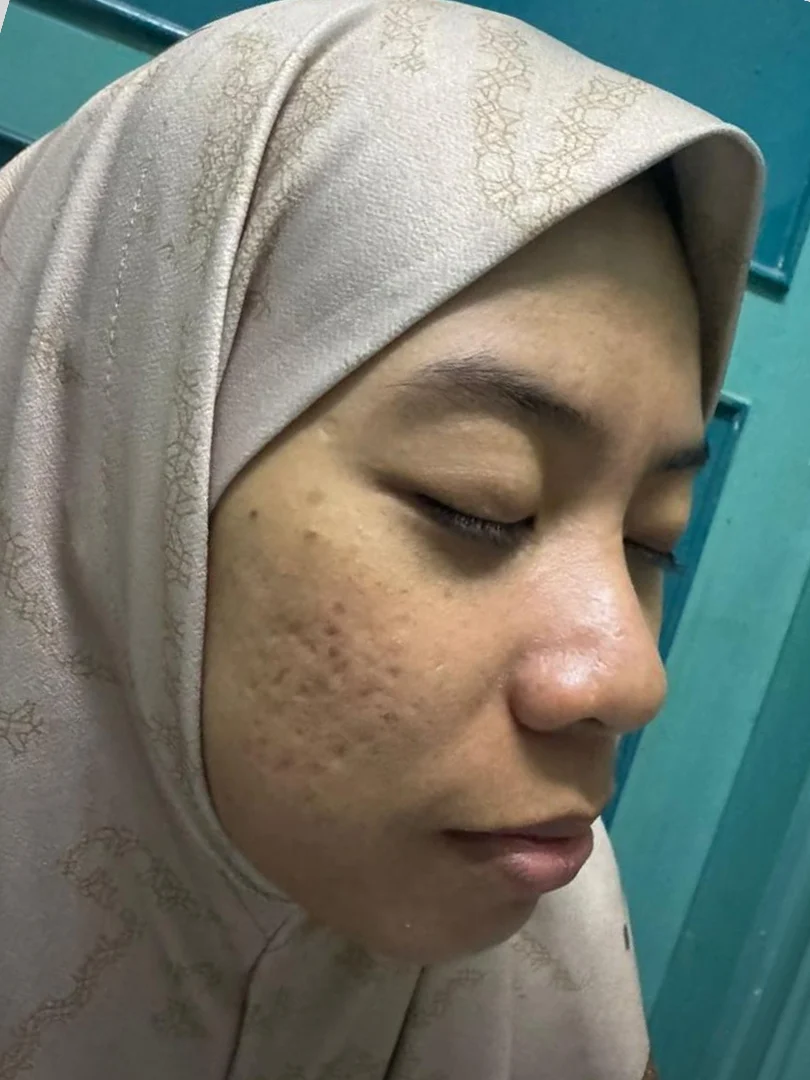 nurul-bef