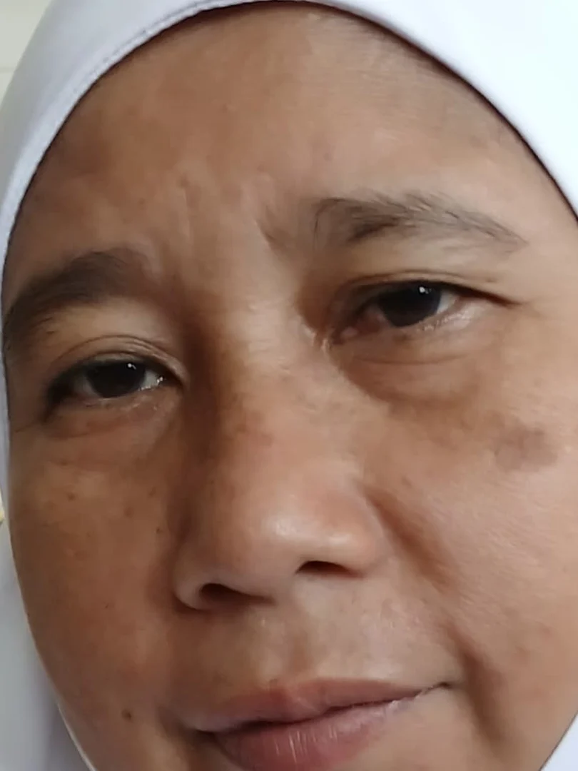 puspa-affter2
